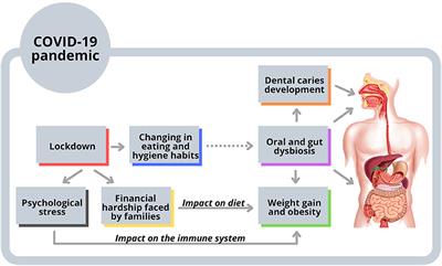 Possible Relationship Between the Oral and Gut Microbiome, Caries Development, and Obesity in Children During the COVID-19 Pandemic